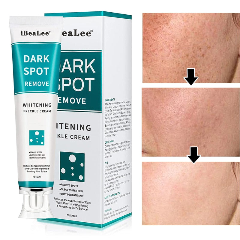 Whitening Cream Dark Spot Remover. This dark spot removing cream instantly enhances the natural radiance of the skin. At night, it works naturally with the rhythm of the skin and starts to reduce the appearance of dark spots, freckles, sun spots, post-acne marks, dullness and redness. The quickly absorbed texture is not sticky, leaving the skin looking bright and translucent. This daily treatment minimizes spots and acne pigmentation, brightens the skin tone and improves uneven skin tone.